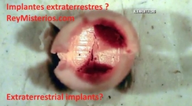 implantes-extraterrestres.jpg