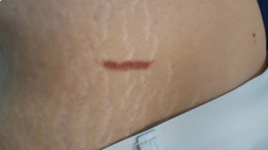 medusas-OVNI3.jpg
